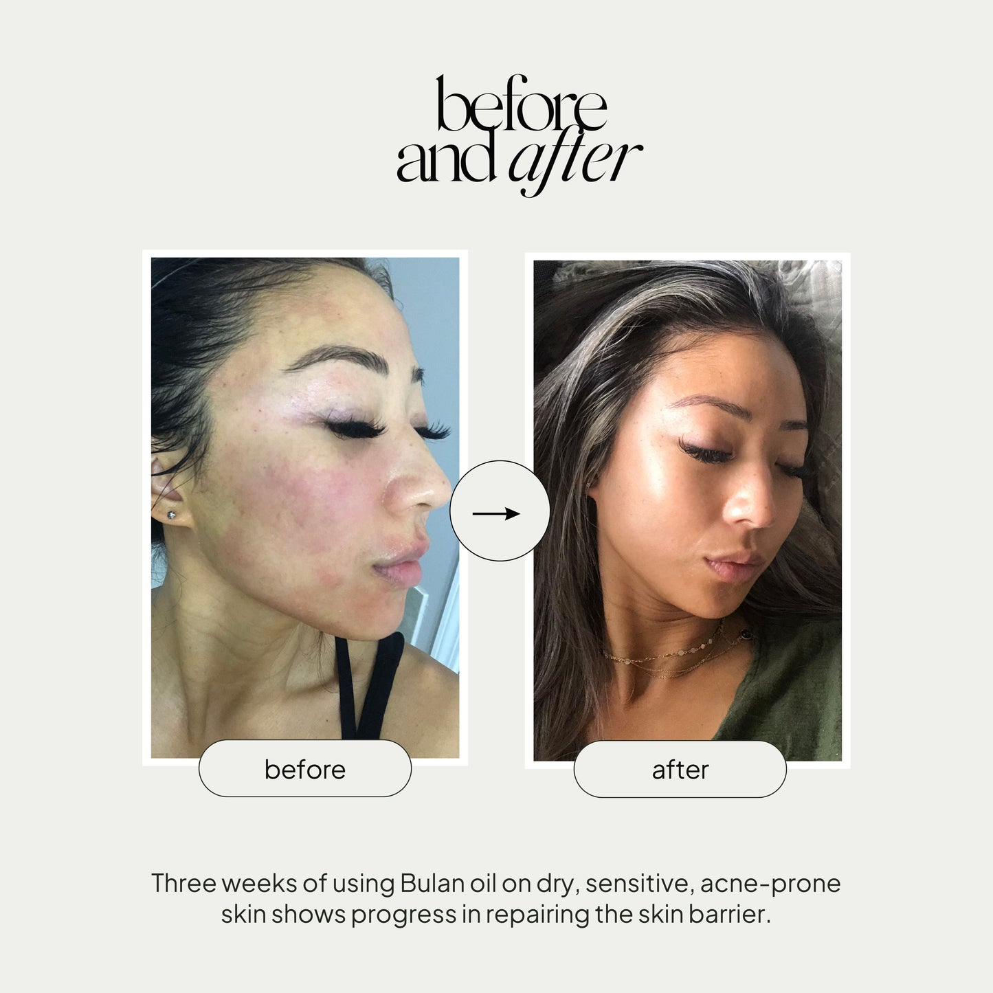 Bulan Nourishing Facial Oil