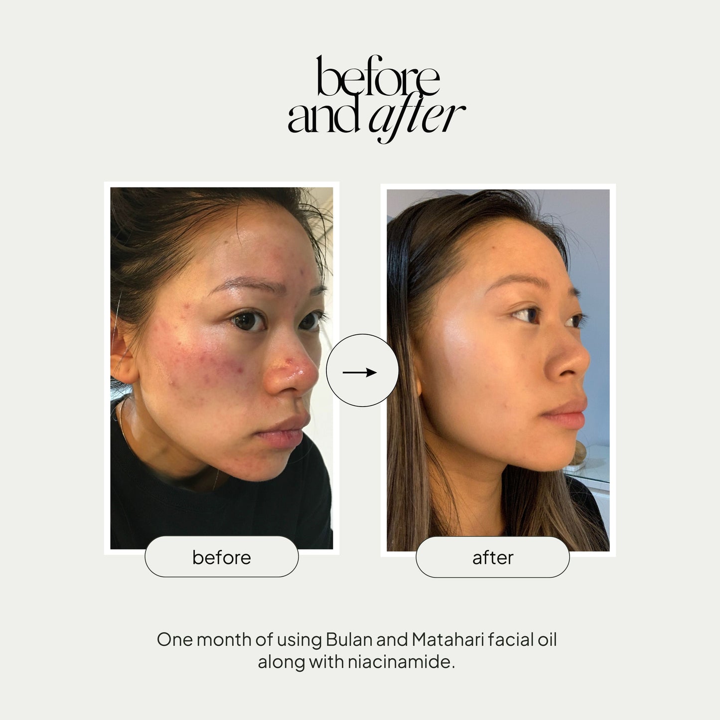 Mini Facial Oil Duo Set